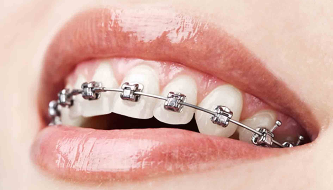 Odontoiatria conservativa